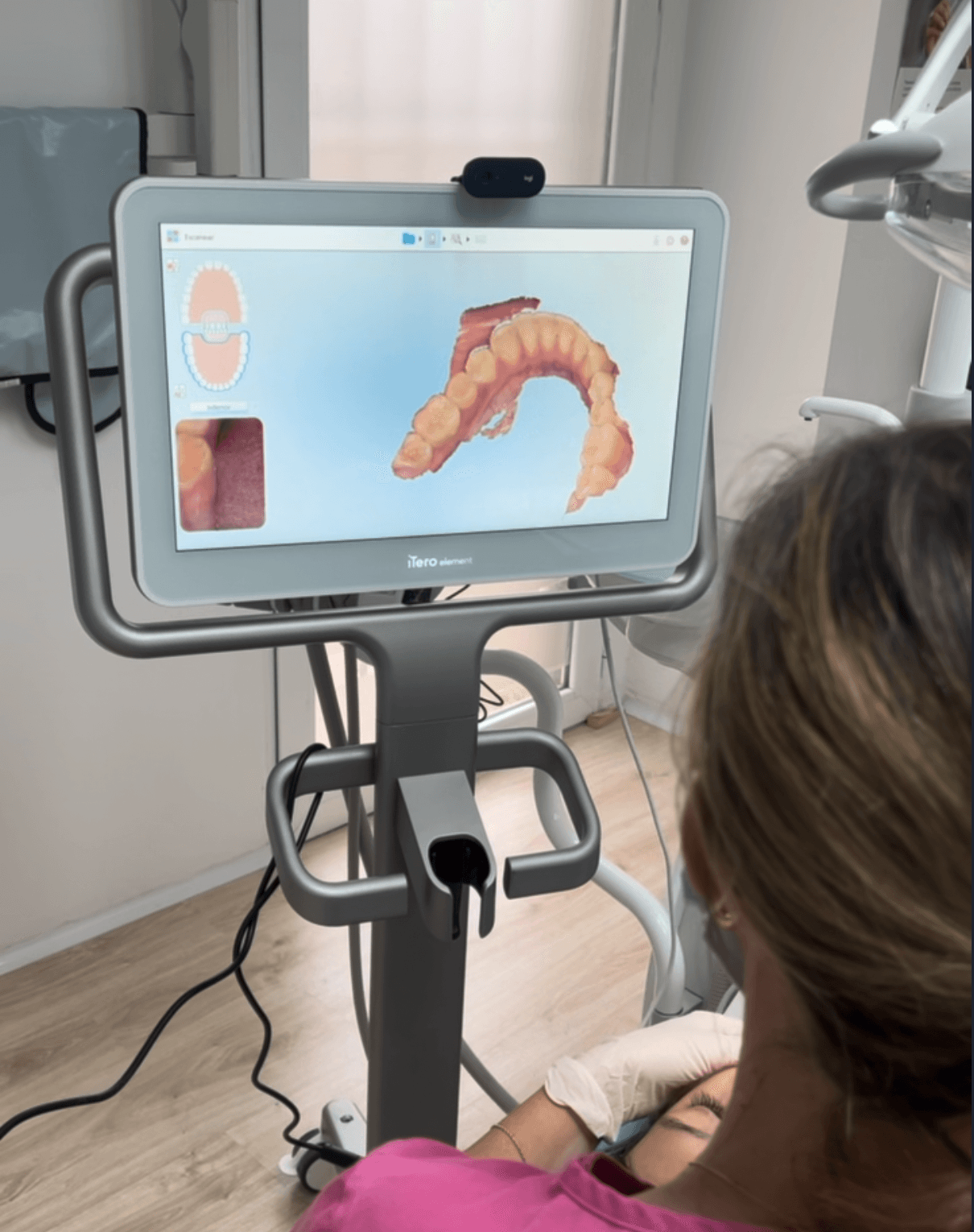 Escáner intraoral iTero Element en Clínica Dental Araque Las Rozas